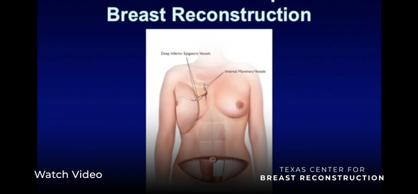 "Living Beyond Breast Cancer" - Breast Reconstruction Part 1